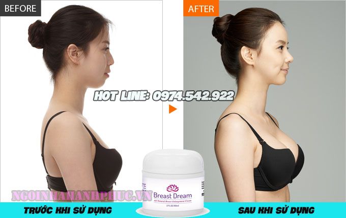kem nở ngực upsize có tốt không